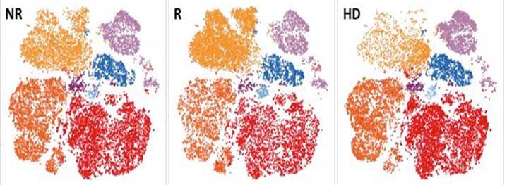 'Instagram' of the immune system predicts response to anti-PD-1 immunotherapy in melanoma